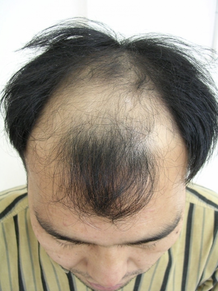 시술전11.jpg