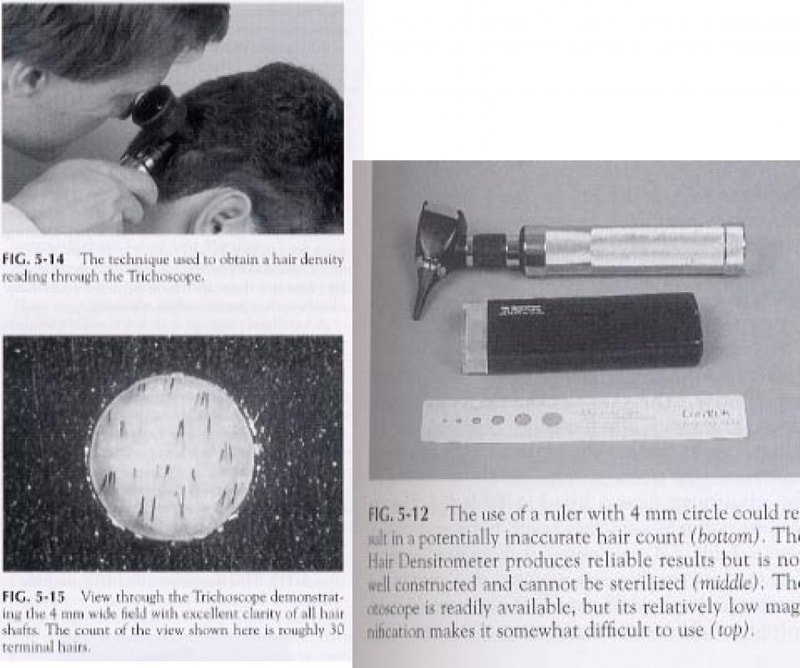hair_densitometer.jpg