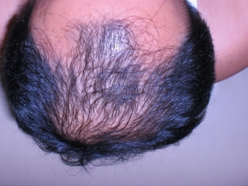 before.JPG