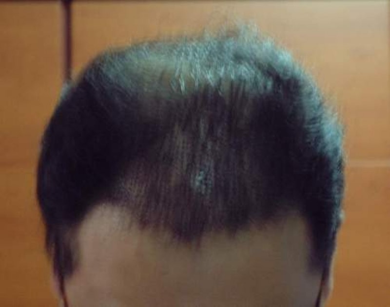 after.JPG