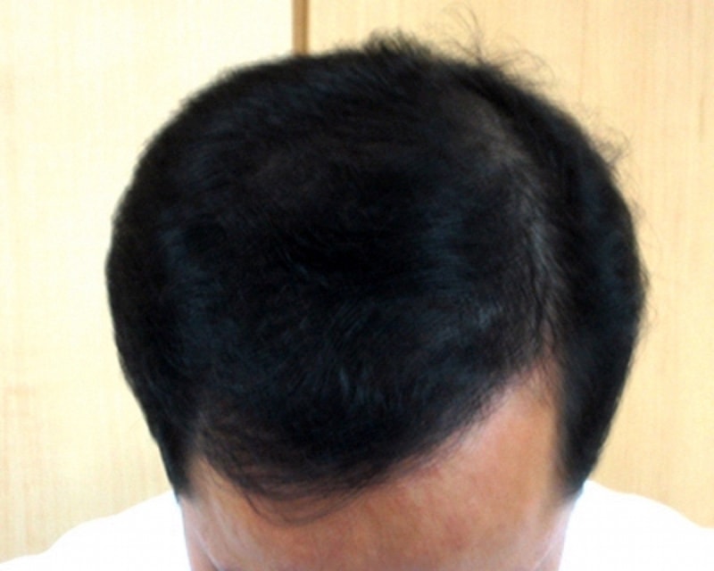 hair2.jpg