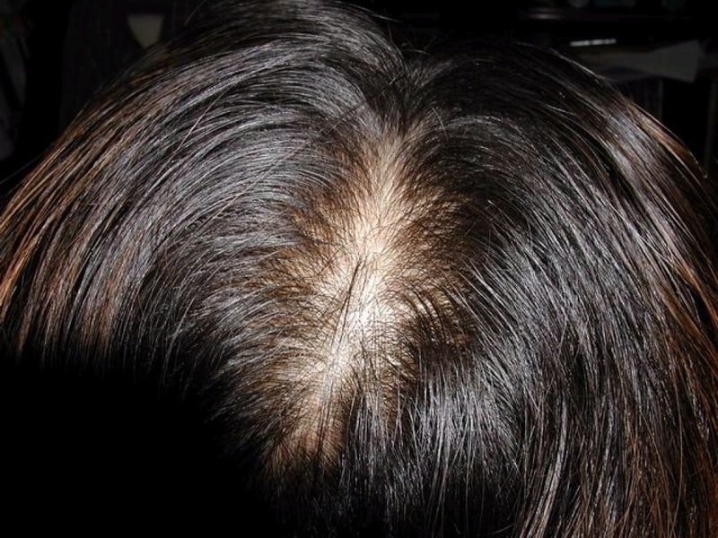 hair1.jpg
