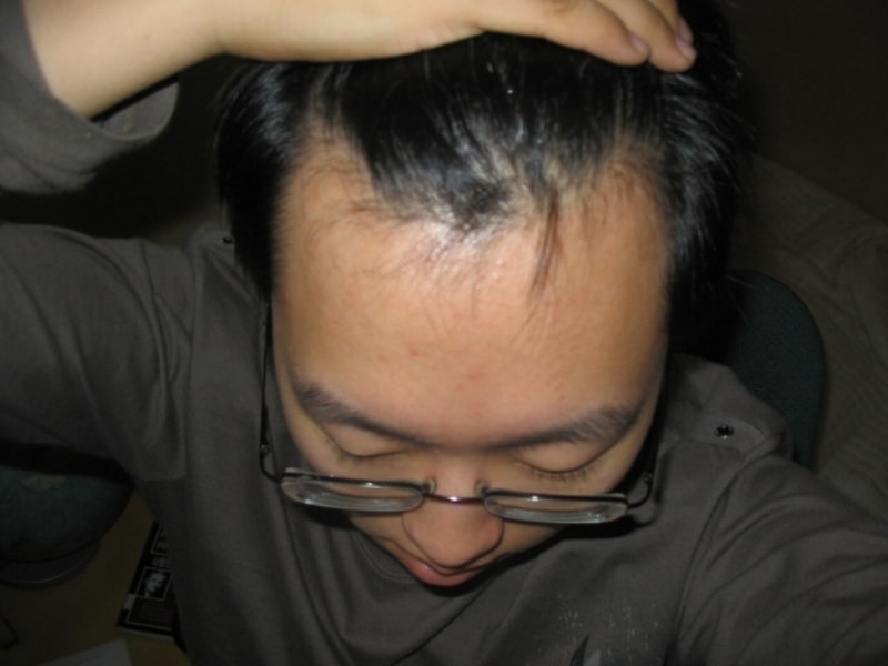 before.JPG
