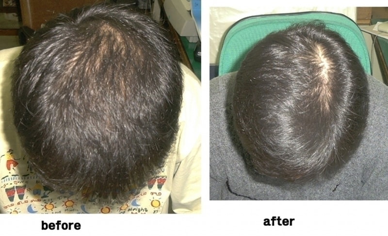 hair.jpg