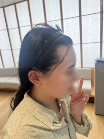 시술전 측면사진