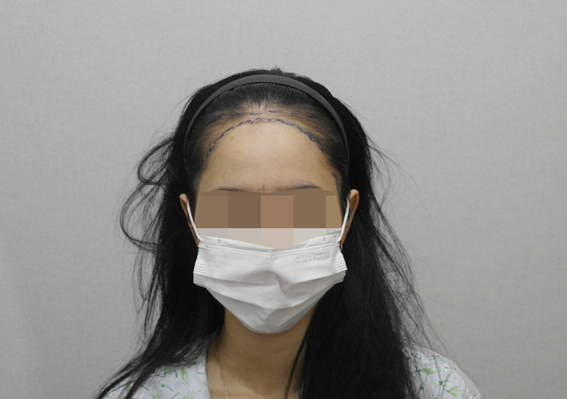 2.디자인후.JPG