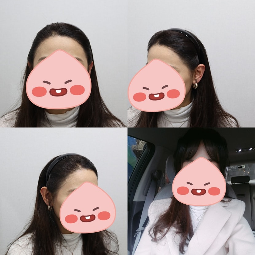 1년 경과입니다. 