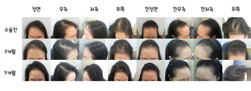 [사진]
