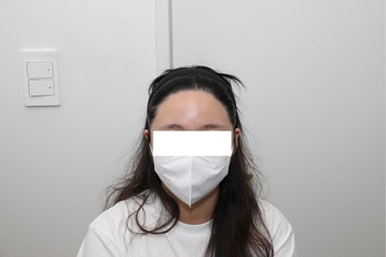 수술 후 1년