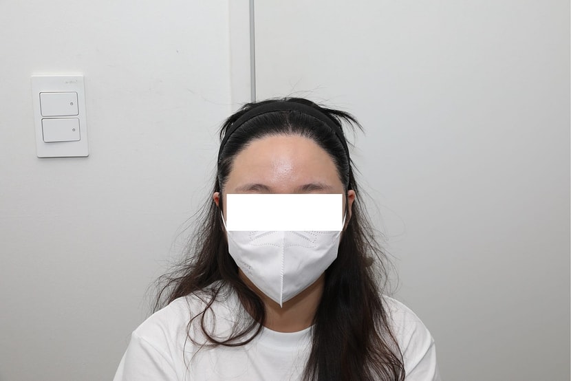 수술 후 1년