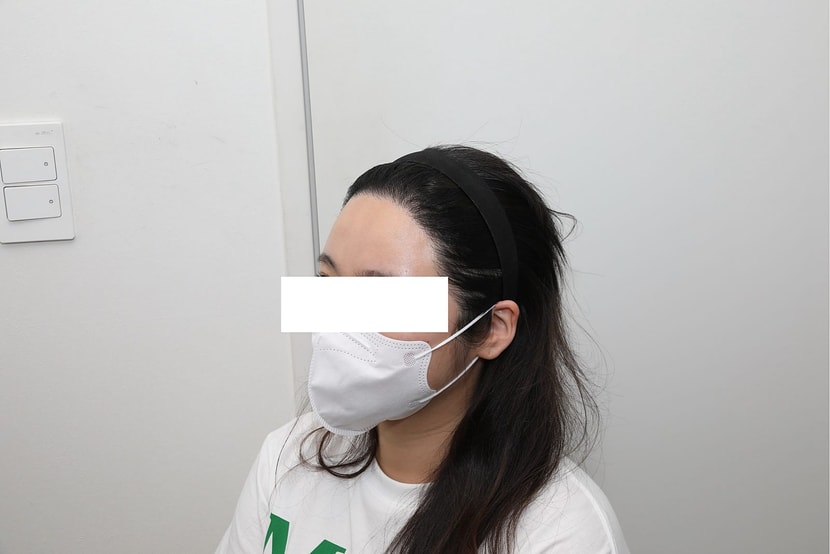 수술 후 1년