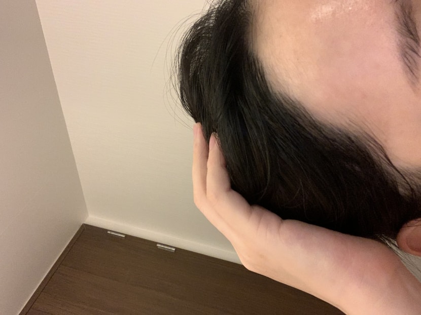 수술 후 1년