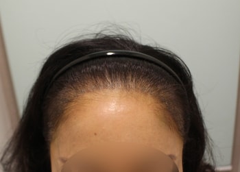 10~11일차 심긴모습