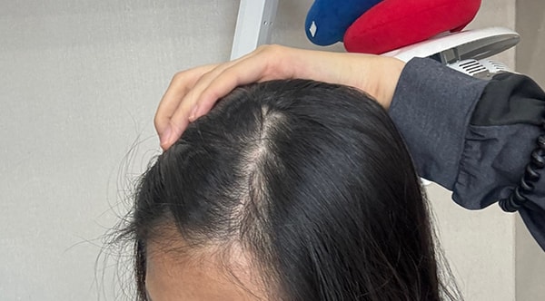 주사3회차 어제 찍은 셀카