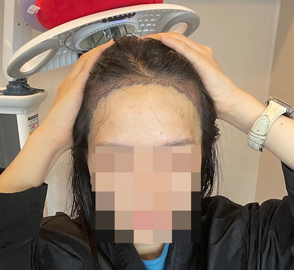 샴푸 케어 받은 후