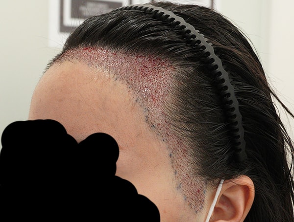 수술 직후 찍은 사진