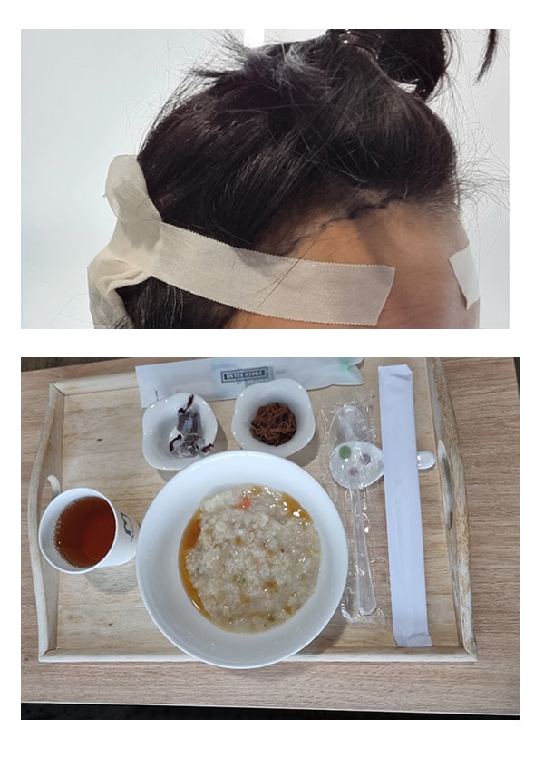 ﻿회복실에서~~~﻿채취끝나면 이 몰골로 나와서 죽먹어요