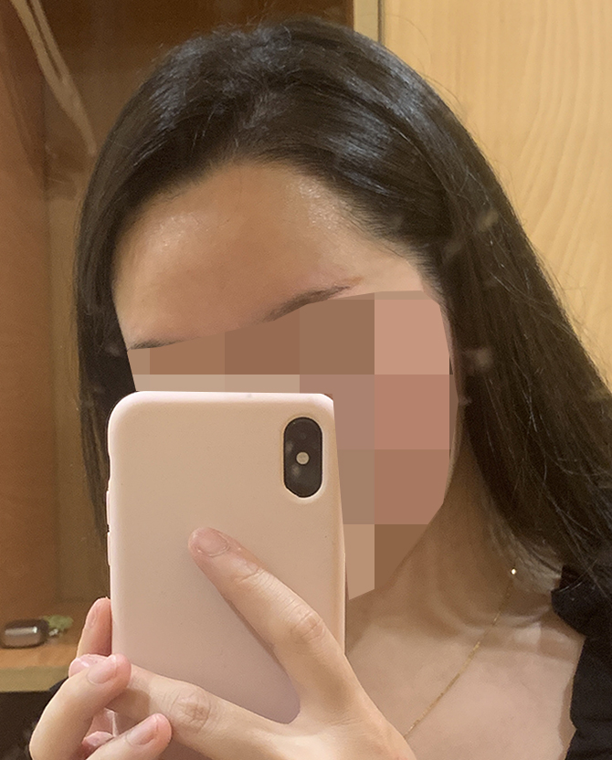 7 최근 셀카 엠자 때문에 스트레스 받았는데 이제 머리 넘길 수 있어서 좋아요.jpg