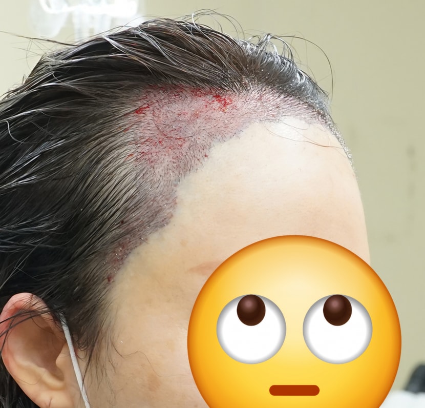 수술직후