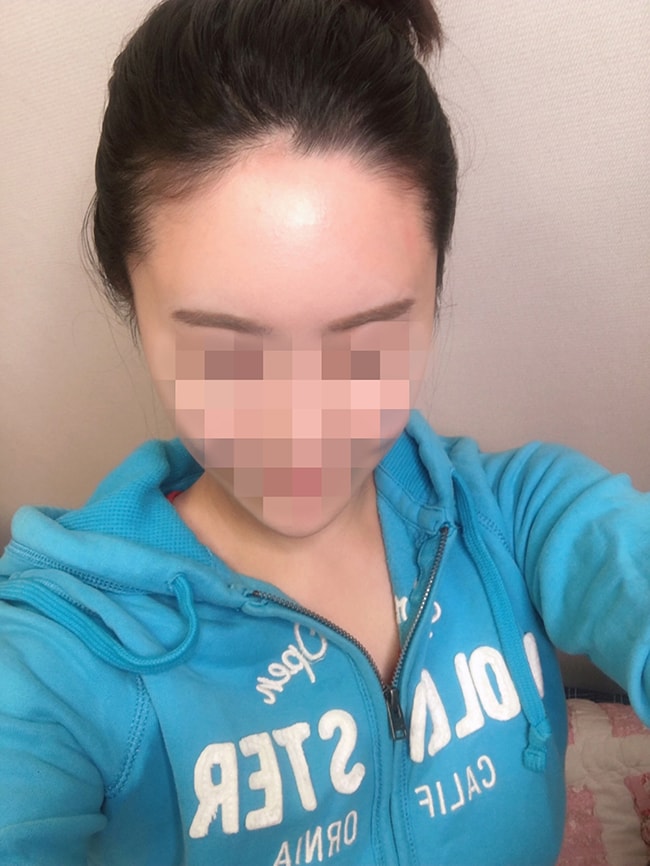 수술 전