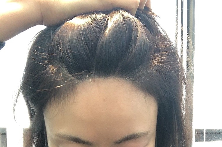 수술전사진~