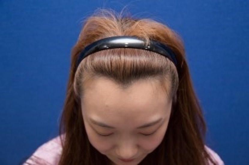이건 수술 당일날!! 
