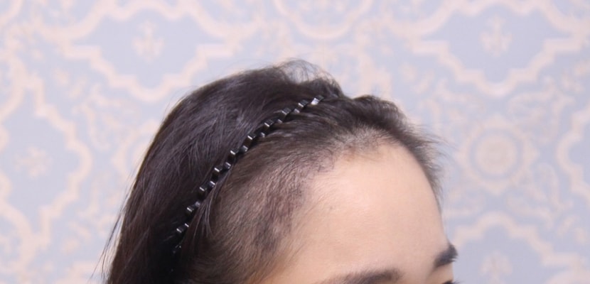 옆모습이에요 ㅎㅎ 