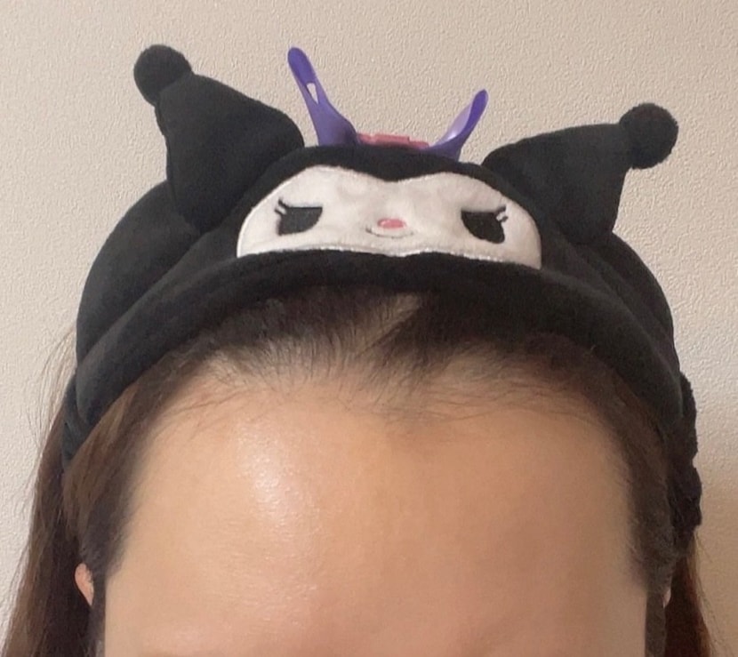 수술 전 사진
