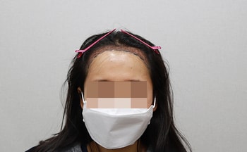 ﻿어제 샴푸받고 찍었어요