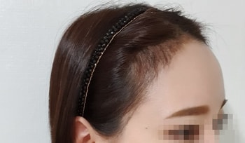 1개월차