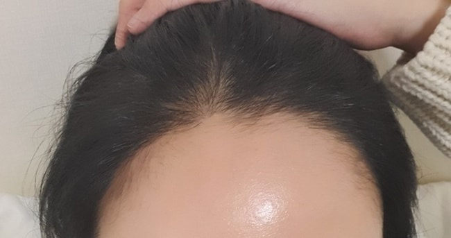 6개월차