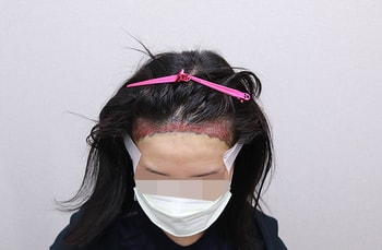 ﻿수술끝나고