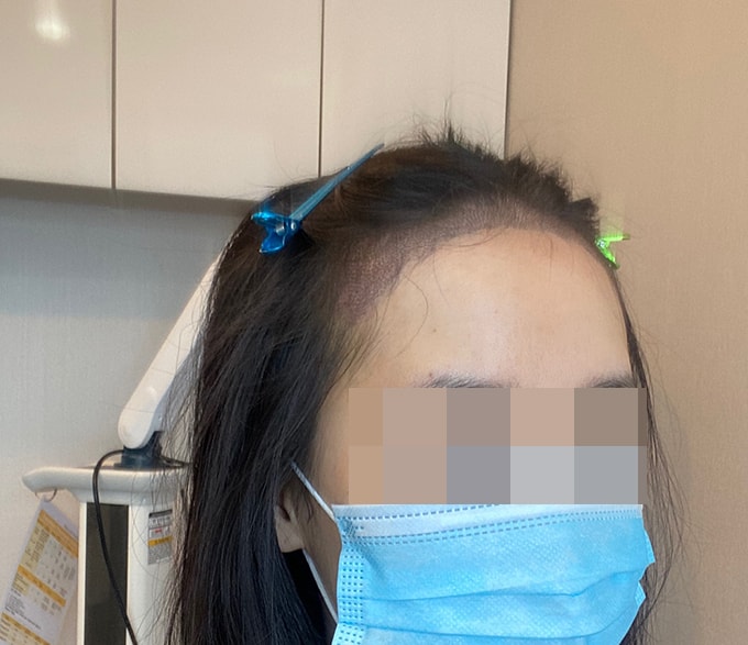 ﻿3월22일 샴푸 받고 폰셀