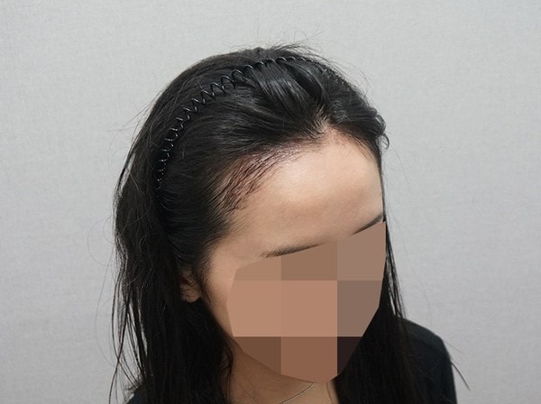 한달차 사진이에용