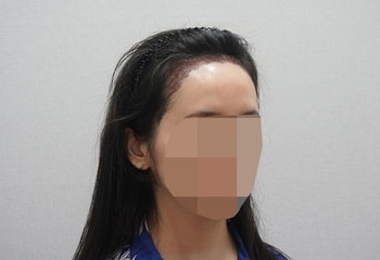 어떤분 글보고 안입는 셔츠입고 갔는데 부담없고 환자복 갈아입을때도 완전 편했어용!