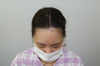 수술전