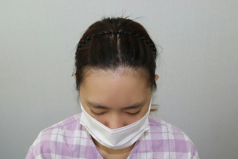 수술전