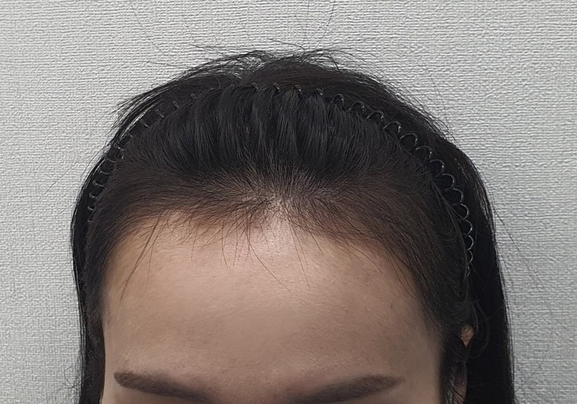 5개월차