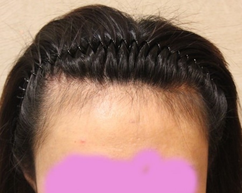 이렇게 각진머리~ 초딩때 이후론 항상 앞머리내리고 다녔어요.