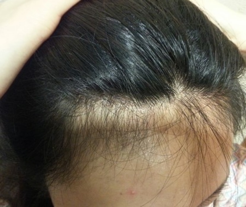 각진거 뿐만아니라 이렇게 잔머리때문에 지저분해보였다는...