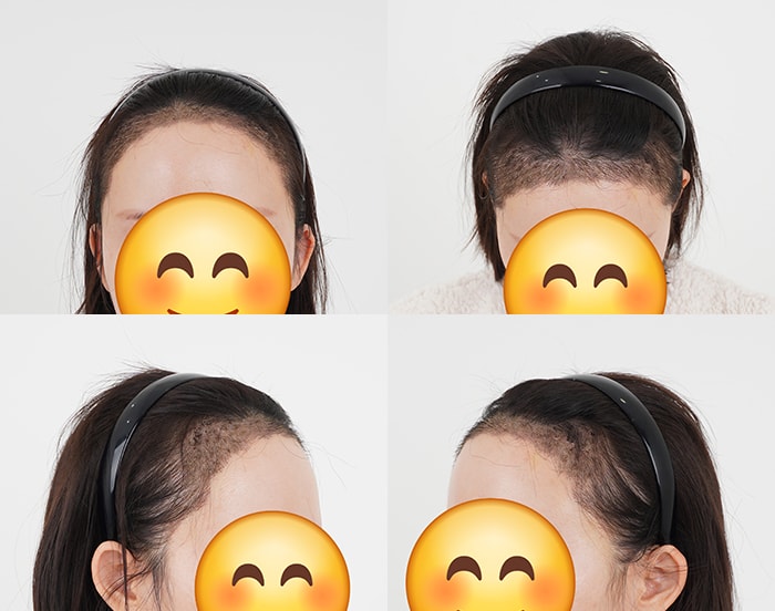 2주