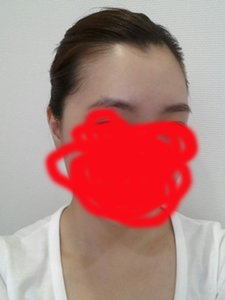 오른쪽 왼쪽 다 심하긴 했어요.