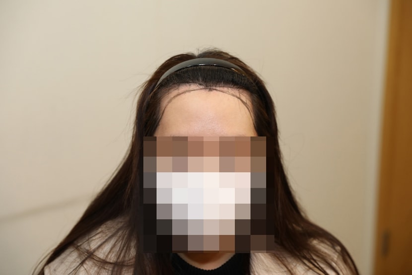 처음에 상담 받았을 때 사진이에요! 정식 디자인 아니에요!