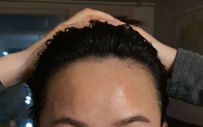 나중에 비교해 보려고 찍은 before 사진이구요...