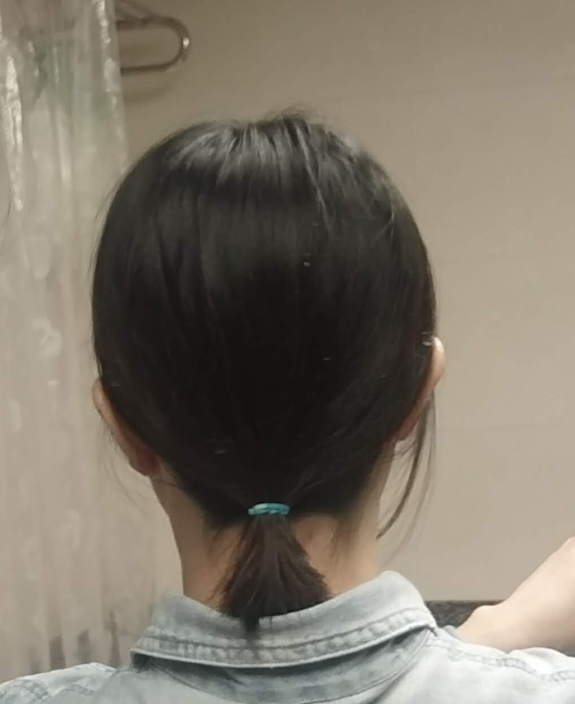    앞머리 내리면 잘 가려지구요, 삭발한 부분은 묶어도 표시 나지 않습니다. 