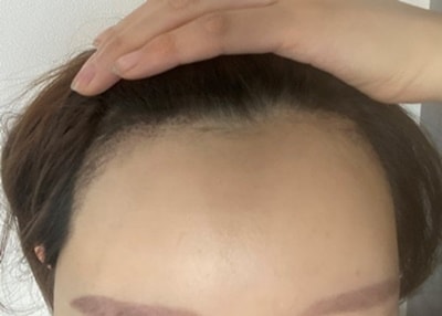 1개월째