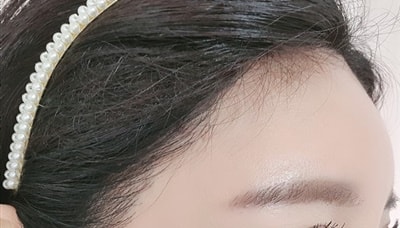 수술후