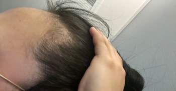 전