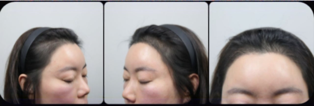 꽉채워진 m자 크읏ㅋ