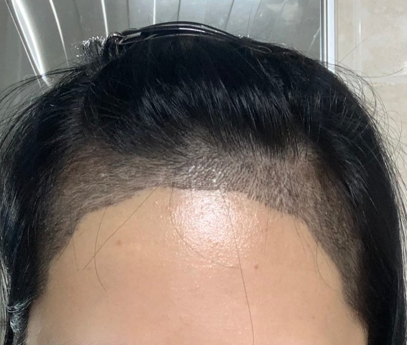 헤어라인 후~~ 촘촘하죠?!